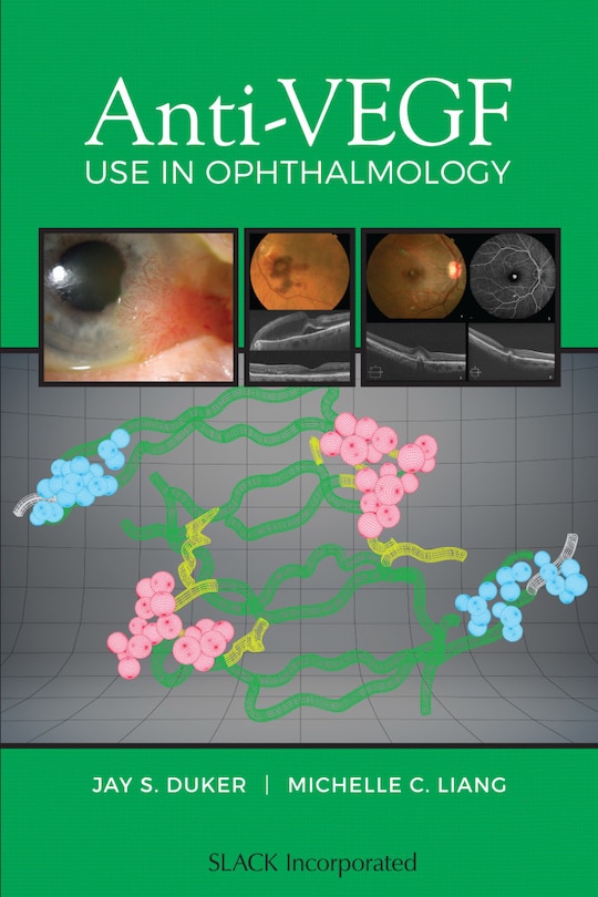 Couverture_Anti-vegf Use In Ophthalmology
