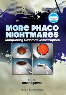 Front cover_More Phaco Nightmares