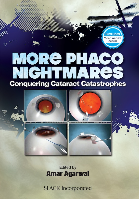 Front cover_More Phaco Nightmares