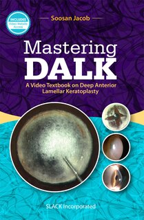 Front cover_Mastering Dalk