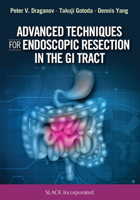 Couverture_Advanced Techniques For Endoscopic Resection In The Gi Tract