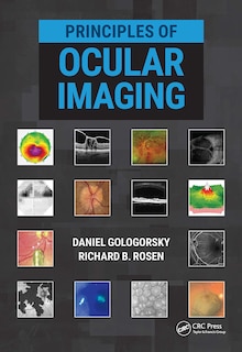 Front cover_Principles Of Ocular Imaging