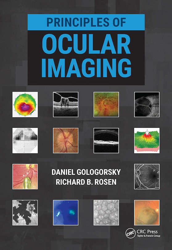 Front cover_Principles Of Ocular Imaging