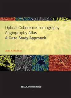 Couverture_Optical Coherence Tomography Angiography Atlas