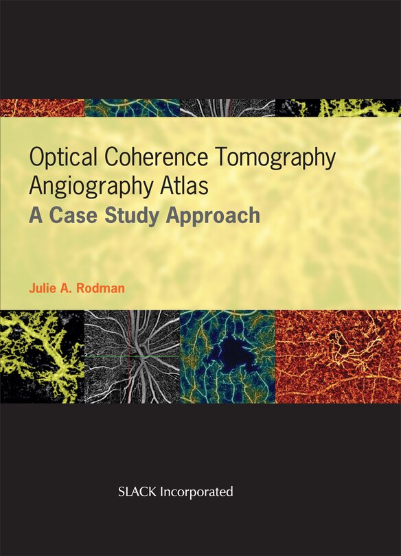 Couverture_Optical Coherence Tomography Angiography Atlas