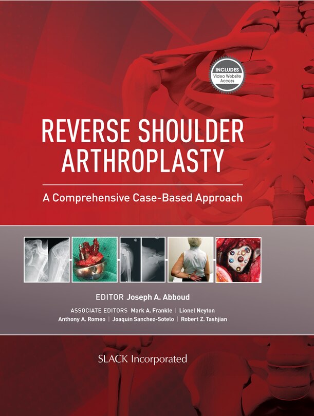 Front cover_Reverse Shoulder Arthroplasty