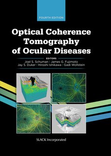 Front cover_Optical Coherence Tomography Of Ocular Diseases
