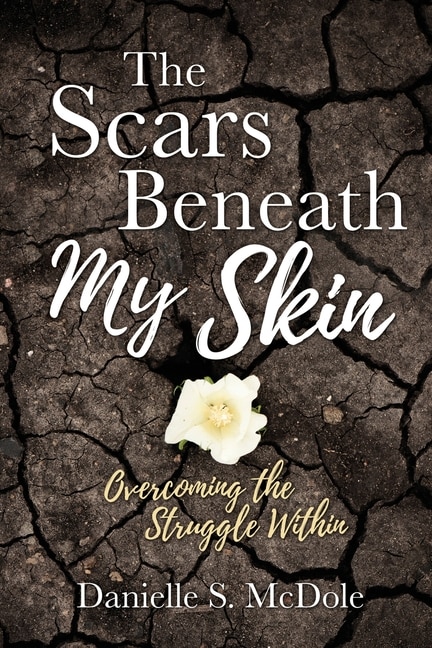 Front cover_The Scars Beneath My Skin