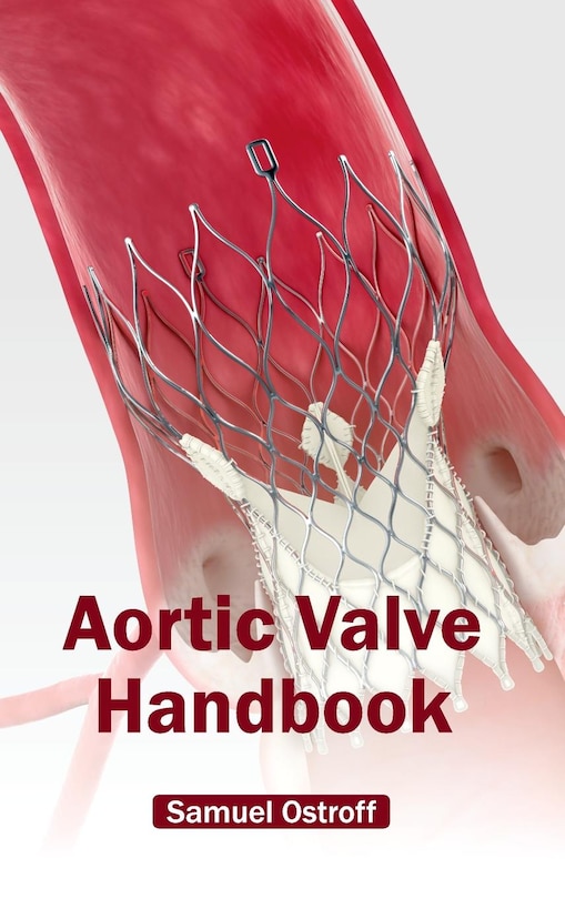 Front cover_Aortic Valve Handbook