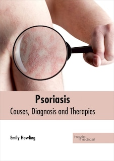 Front cover_Psoriasis: Causes, Diagnosis And Therapies