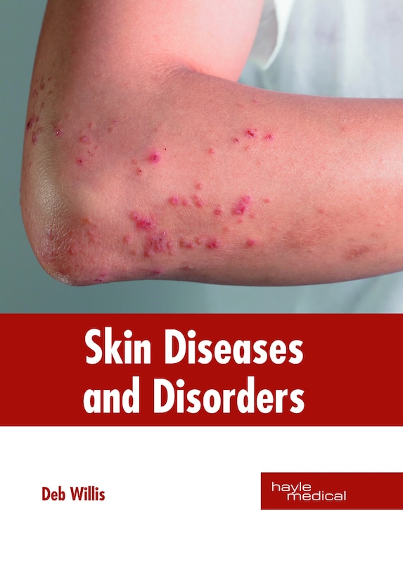 Front cover_Skin Diseases And Disorders