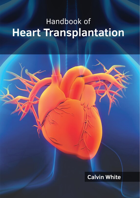 Handbook Of Heart Transplantation