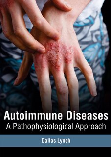 Couverture_Autoimmune Diseases: A Pathophysiological Approach