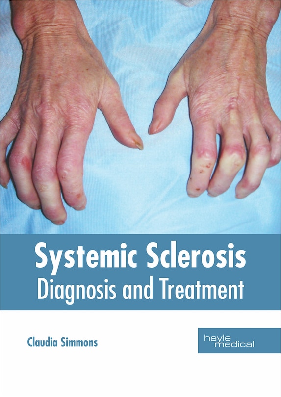 Couverture_Systemic Sclerosis: Diagnosis And Treatment