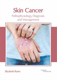 Front cover_Skin Cancer: Pathophysiology, Diagnosis And Management