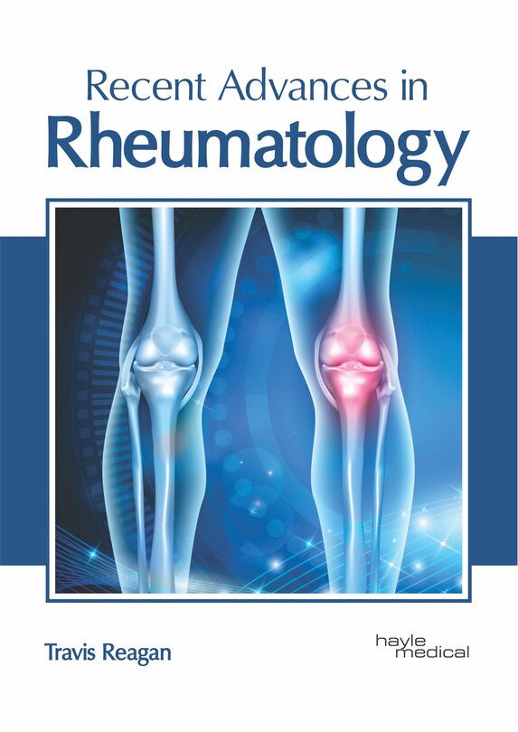 Front cover_Recent Advances In Rheumatology