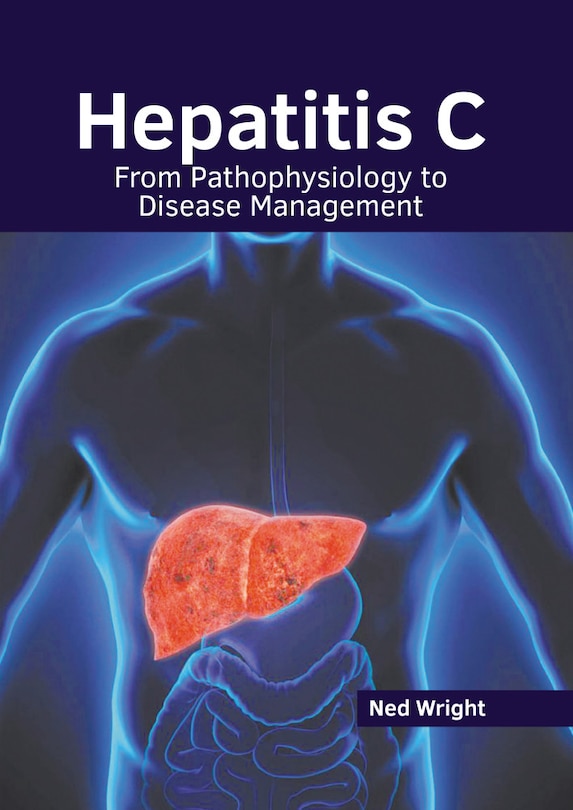 Couverture_Hepatitis C: From Pathophysiology To Disease Management