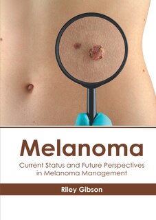 Melanoma: Current Status And Future Perspectives In Melanoma Management