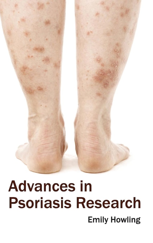 Advances in Psoriasis Research