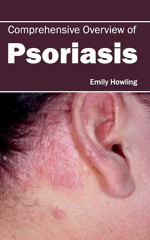 Couverture_Comprehensive Overview of Psoriasis