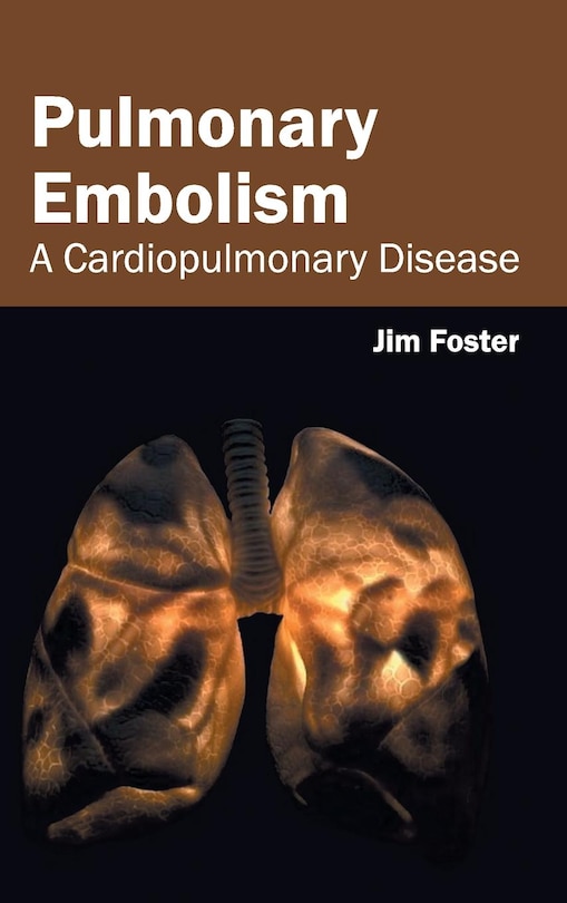 Front cover_Pulmonary Embolism: A Cardiopulmonary Disease