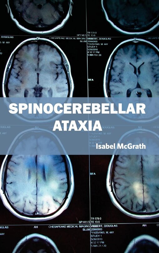 Front cover_Spinocerebellar Ataxia