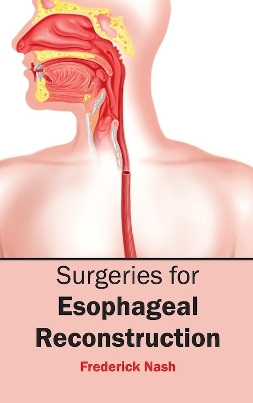 Front cover_Surgeries for Esophageal Reconstruction
