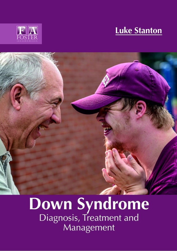 Couverture_Down Syndrome: Diagnosis, Treatment And Management