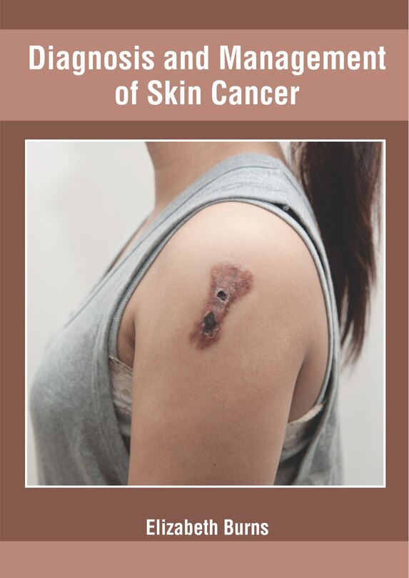 Diagnosis And Management Of Skin Cancer