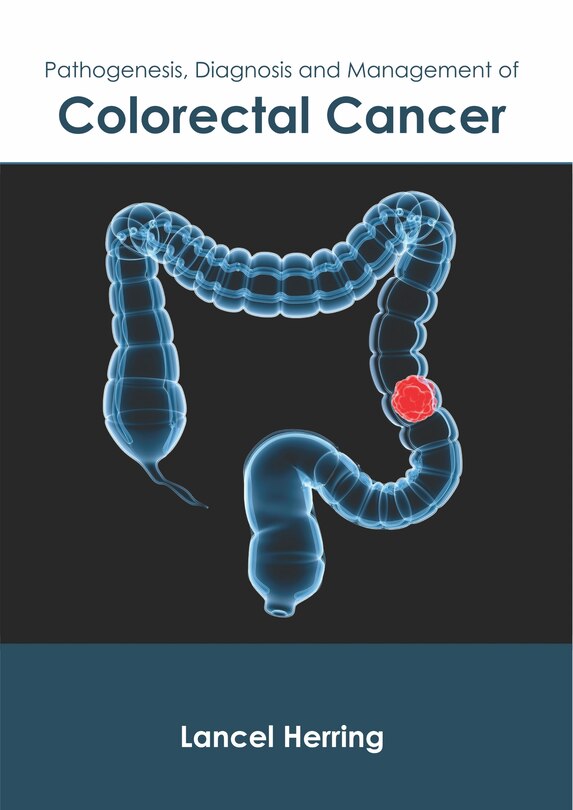 Front cover_Pathogenesis, Diagnosis And Management Of Colorectal Cancer