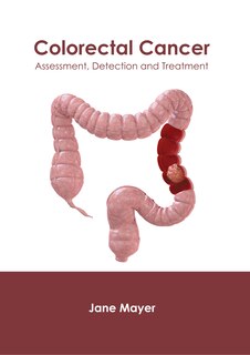 Front cover_Colorectal Cancer: Assessment, Detection And Treatment