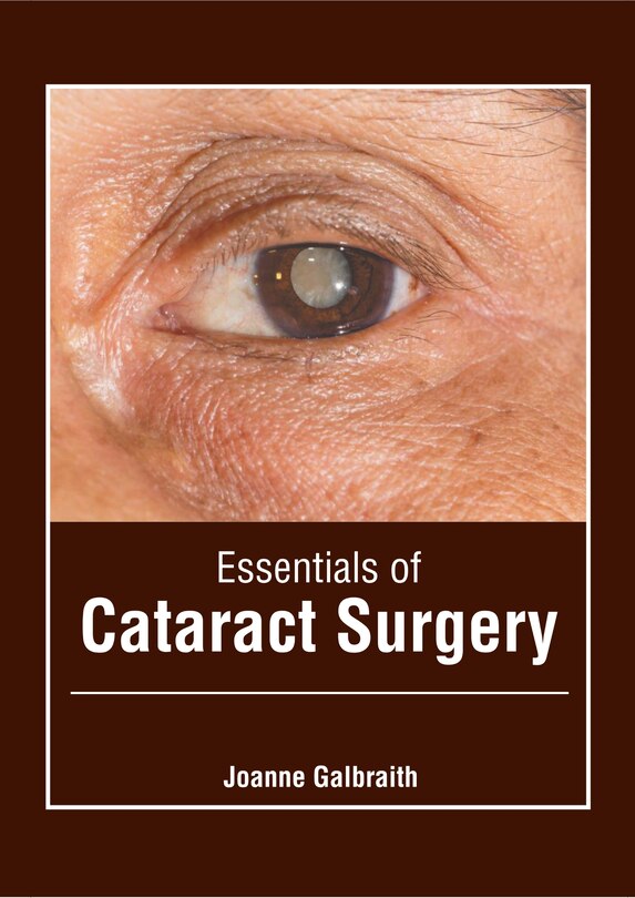 Couverture_Essentials Of Cataract Surgery