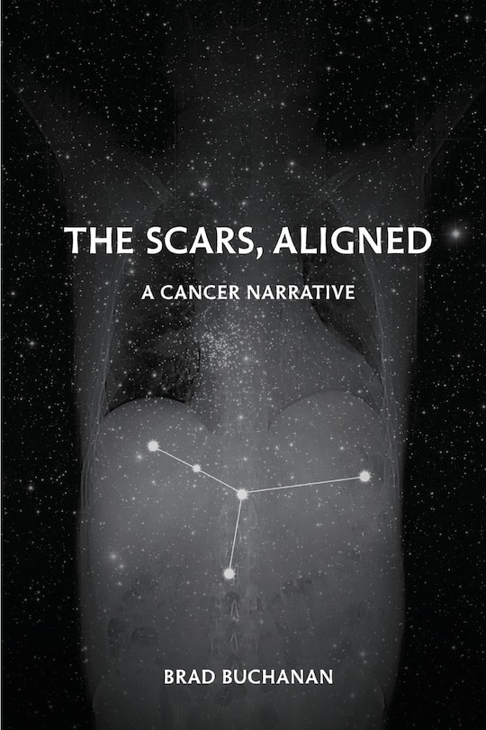 Front cover_The Scars, Aligned
