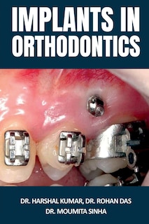 Front cover_Implants in Orthodontics