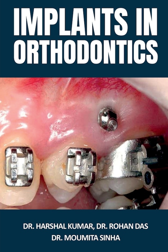 Front cover_Implants in Orthodontics