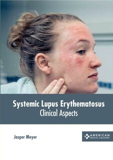 Front cover_Systemic Lupus Erythematosus: Clinical Aspects