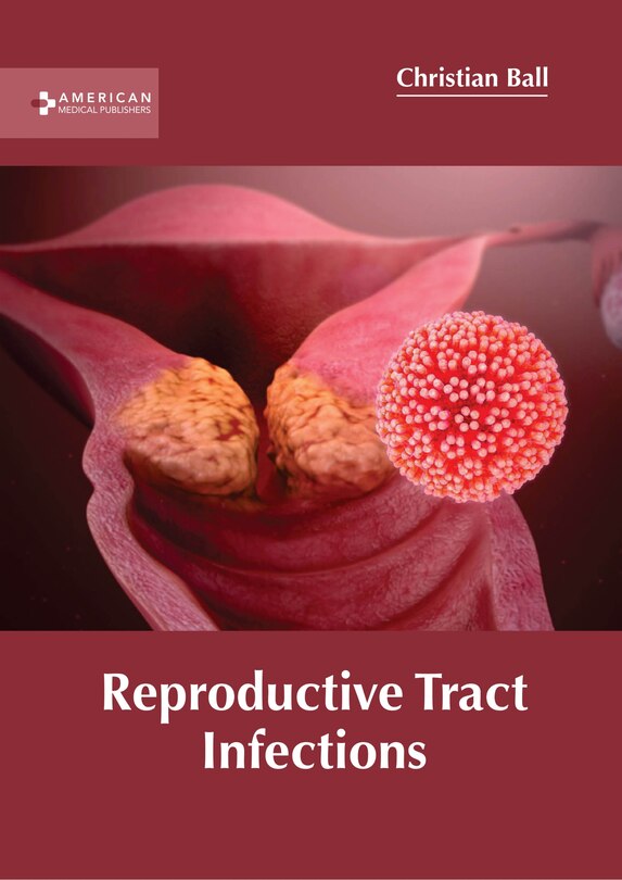 Reproductive Tract Infections