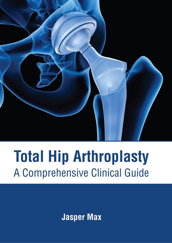 Front cover_Total Hip Arthroplasty: A Comprehensive Clinical Guide
