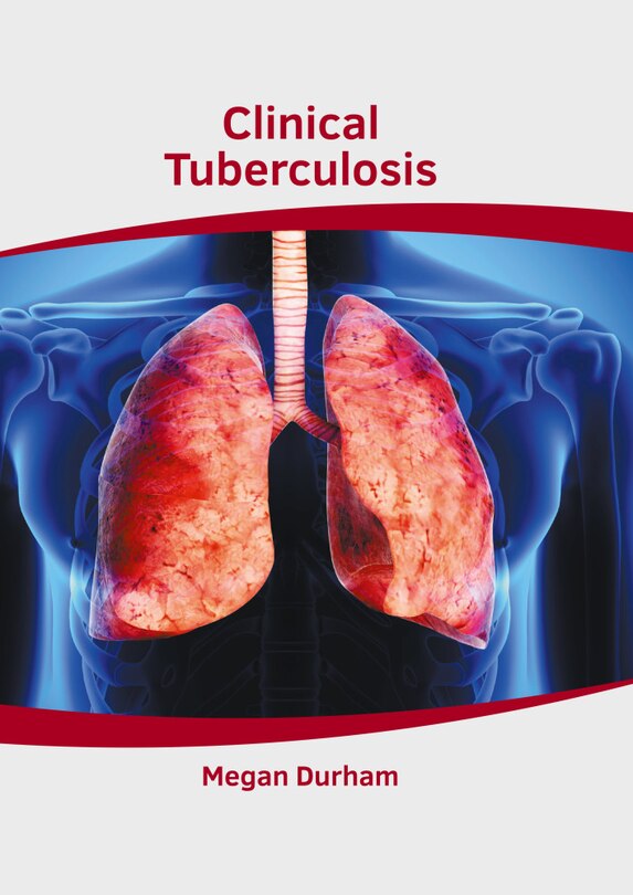 Front cover_Clinical Tuberculosis