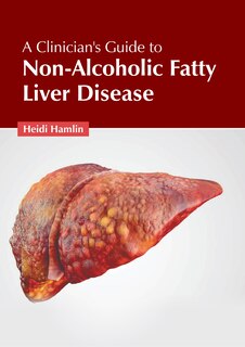 Front cover_A Clinician's Guide to Non-Alcoholic Fatty Liver Disease