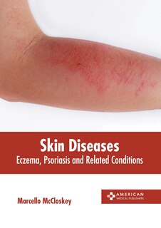 Couverture_Skin Diseases: Eczema, Psoriasis and Related Conditions
