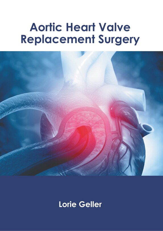 Front cover_Aortic Heart Valve Replacement Surgery