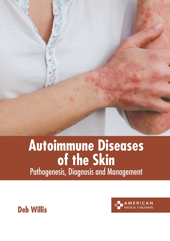 Couverture_Autoimmune Diseases of the Skin: Pathogenesis, Diagnosis and Management