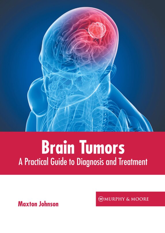 Front cover_Brain Tumors: A Practical Guide to Diagnosis and Treatment