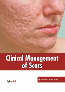 Front cover_Clinical Management Of Scars
