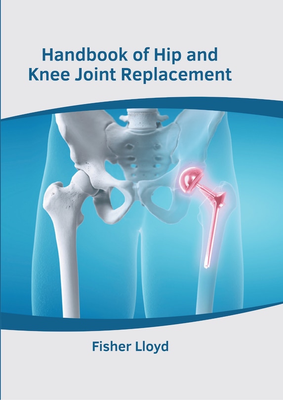 Couverture_Handbook of Hip and Knee Joint Replacement