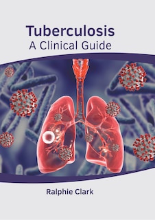 Front cover_Tuberculosis: A Clinical Guide