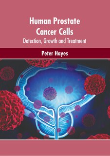 Front cover_Human Prostate Cancer Cells: Detection, Growth and Treatment
