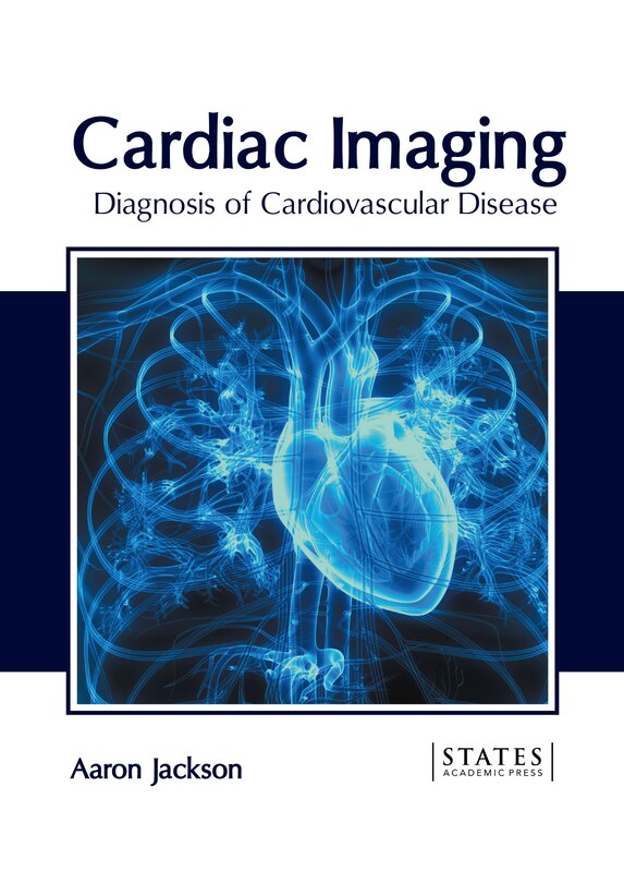 Front cover_Cardiac Imaging: Diagnosis of Cardiovascular Disease
