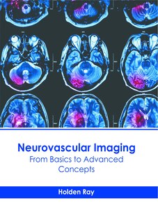 Front cover_Neurovascular Imaging: From Basics to Advanced Concepts